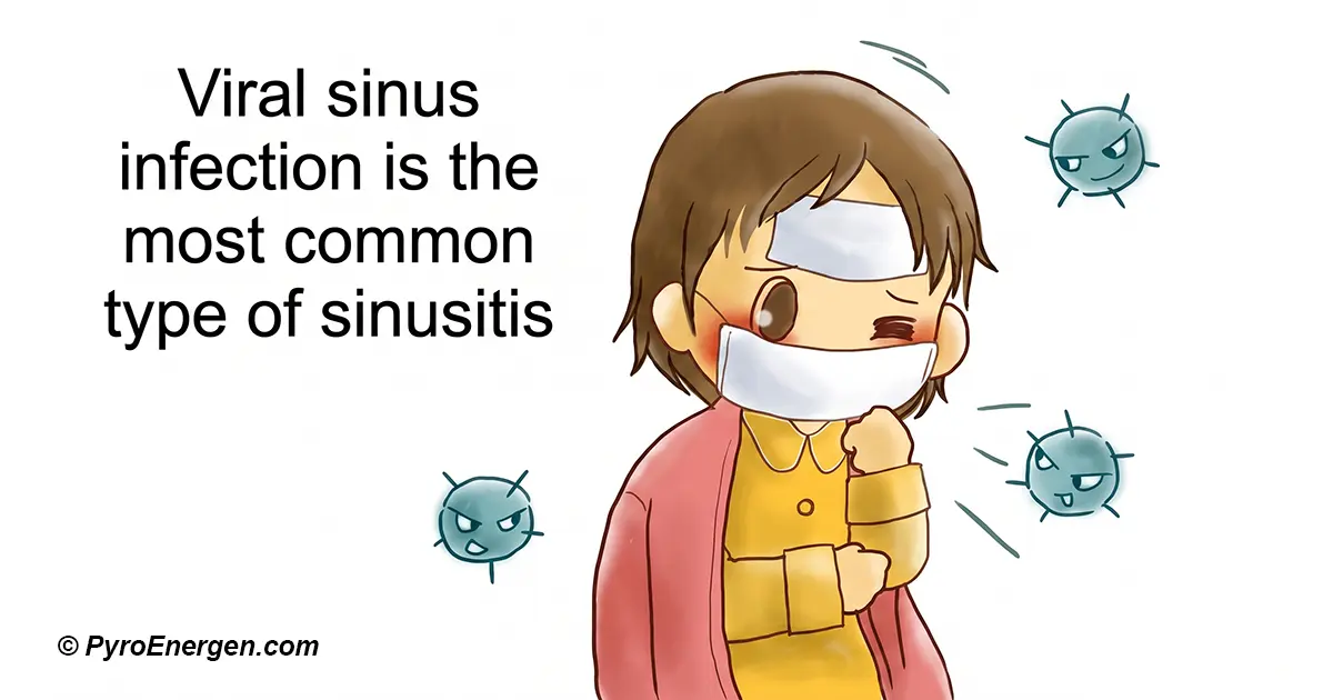 Bacterial sinusitis is a complication of viral sinusitis